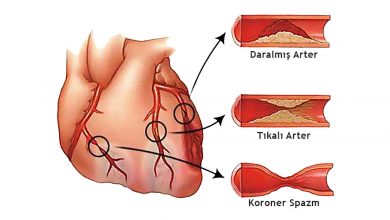 Koroner Kalp Hastalığı